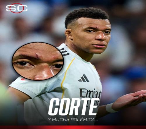 Mythic,补丁后遭遇,更多削弱调,世界杯转播,2026世界杯,赛事观看,转播频道,体育直播